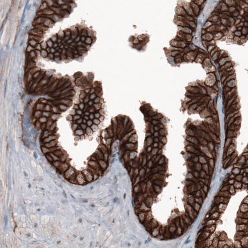 beta-Catenin Antibody (CL3691) - Azide and BSA Free Immunohistochemistry-Paraffin: beta-Catenin Antibody [NBP3-44057]
