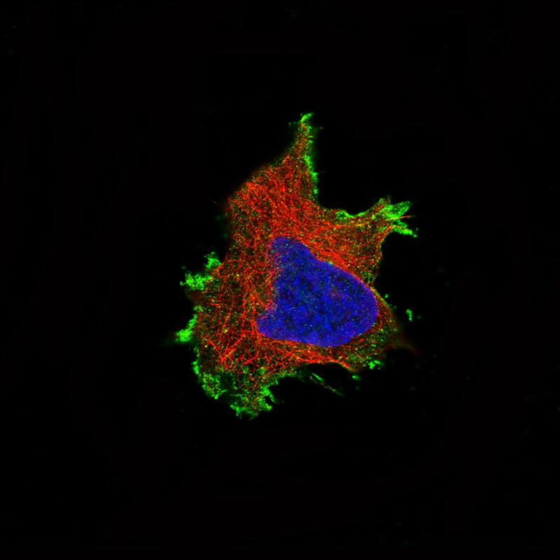 beta-Catenin Antibody (CL3691) - Azide and BSA Free Immunocytochemistry/ Immunofluorescence: beta-Catenin Antibody [NBP3-44057]