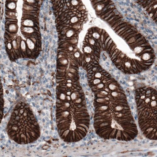 beta-Catenin Antibody (CL3691) - Azide and BSA Free Immunohistochemistry-Paraffin: beta-Catenin Antibody [NBP3-44057]