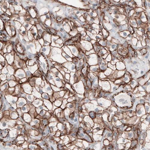beta-Catenin Antibody (CL3691) - Azide and BSA Free Immunohistochemistry-Paraffin: beta-Catenin Antibody [NBP3-44057]