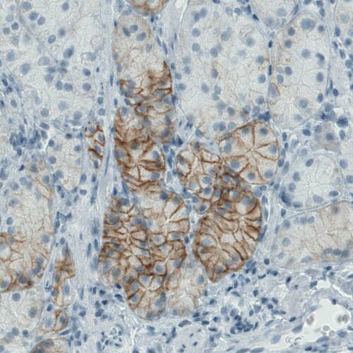 Carbonic Anhydrase XII/CA12 Antibody (CL0278) - Azide and BSA Free Immunohistochemistry-Paraffin: Carbonic Anhydrase XII/CA12 Antibody [NBP3-44058]