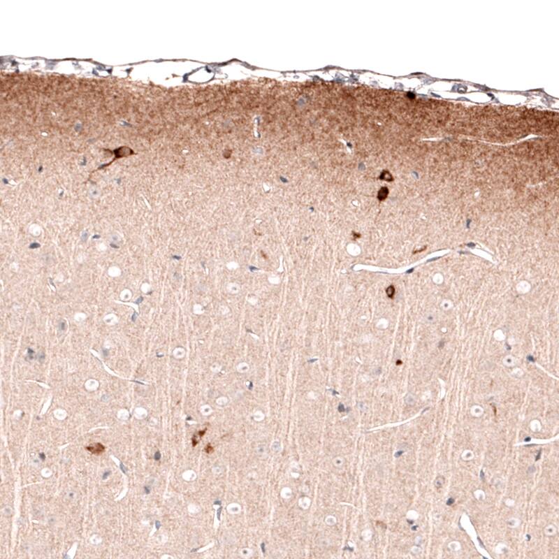 Reelin Antibody (CL5324) - Azide and BSA Free Immunohistochemistry-Paraffin: Reelin Antibody [NBP3-44060]