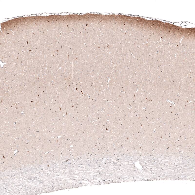 Reelin Antibody (CL5324) - Azide and BSA Free Immunohistochemistry-Paraffin: Reelin Antibody [NBP3-44060]