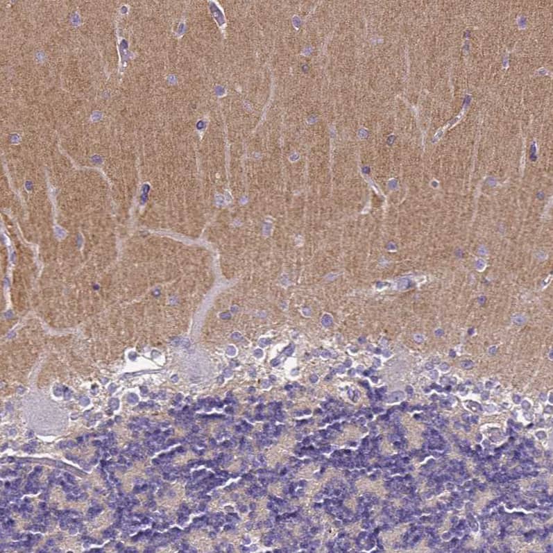 TSPAN7/TM4SF2 Antibody (CL0262) - Azide and BSA Free Immunohistochemistry-Paraffin: TSPAN7/TM4SF2 Antibody [NBP3-44061]