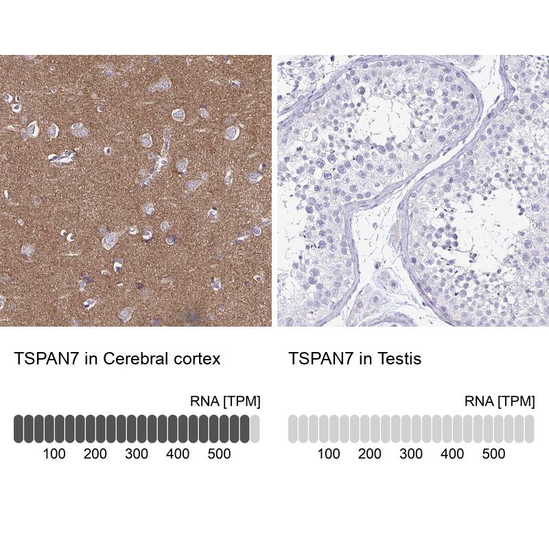 TSPAN7/TM4SF2 Antibody (CL0262) - Azide and BSA Free Immunohistochemistry-Paraffin: TSPAN7/TM4SF2 Antibody [NBP3-44061]