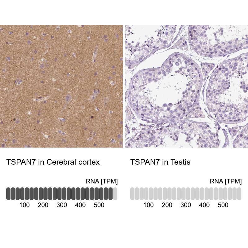 TSPAN7/TM4SF2 Antibody (CL0265) - Azide and BSA Free Immunohistochemistry-Paraffin: TSPAN7/TM4SF2 Antibody [NBP3-44062]