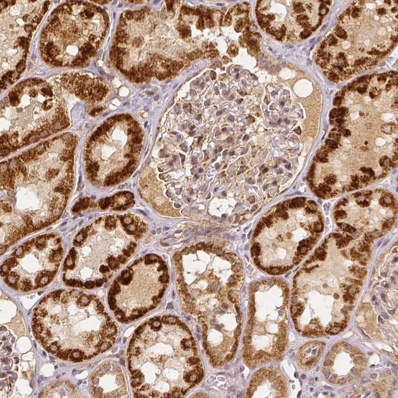 Rhot1 Antibody (CL1083) - Azide and BSA Free Immunohistochemistry-Paraffin: Rhot1 Antibody [NBP3-44063]