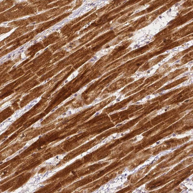 Rhot1 Antibody (CL1083) - Azide and BSA Free Immunohistochemistry-Paraffin: Rhot1 Antibody [NBP3-44063]