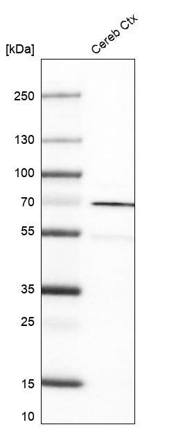 Rhot1 Antibody (CL1083) - Azide and BSA Free Western Blot: Rhot1 Antibody [NBP3-44063]