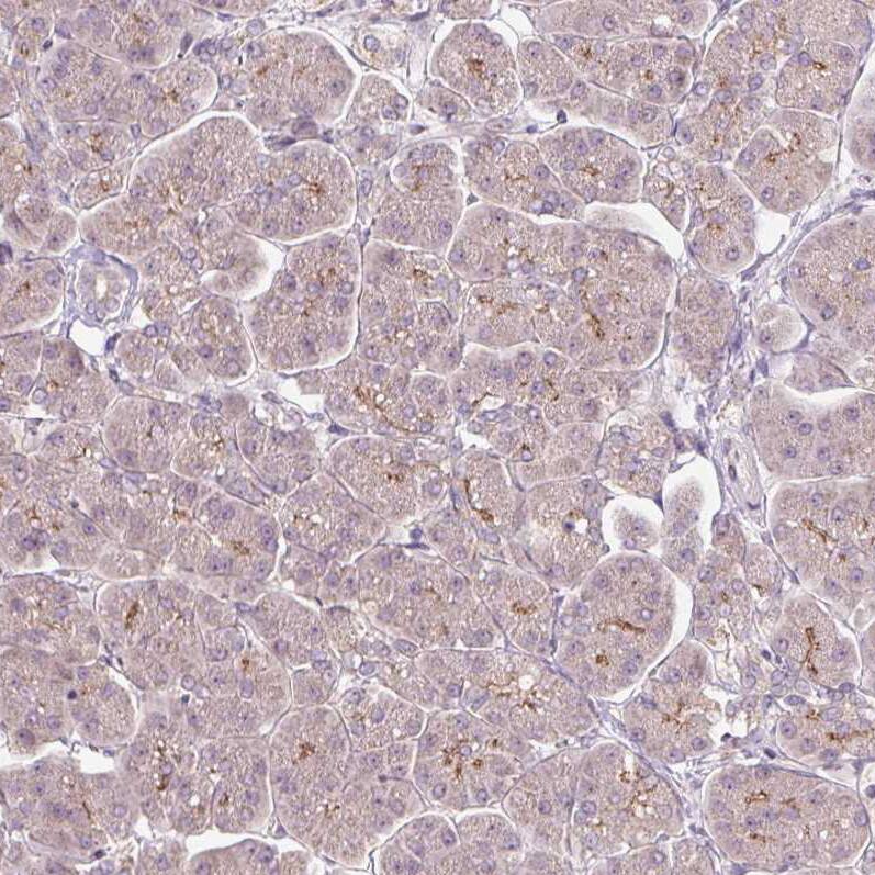 PCM1 Antibody (CL0206) - Azide and BSA Free Immunohistochemistry-Paraffin: PCM1 Antibody [NBP3-44065]