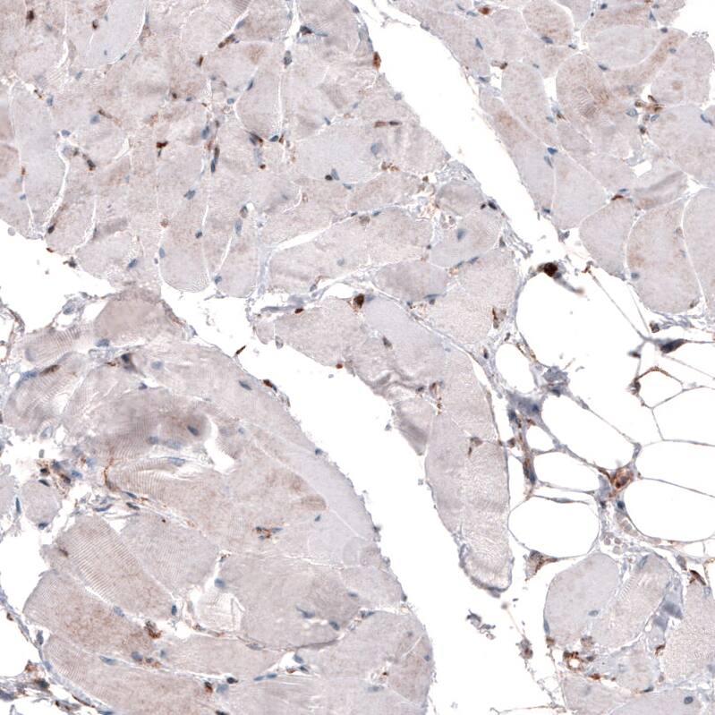 Cyclophilin B Antibody (CL3901) - Azide and BSA Free Immunohistochemistry-Paraffin: Cyclophilin B Antibody [NBP3-44066]