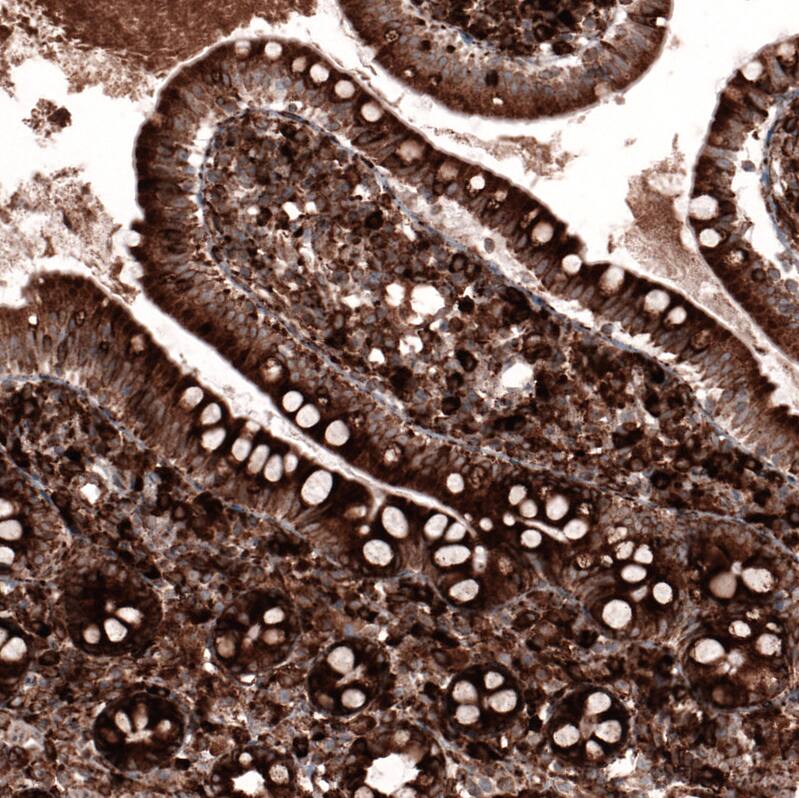 Cyclophilin B Antibody (CL3901) - Azide and BSA Free Immunohistochemistry-Paraffin: Cyclophilin B Antibody [NBP3-44066]