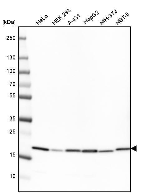 Cyclophilin B Antibody (CL3901) - Azide and BSA Free Western Blot: Cyclophilin B Antibody [NBP3-44066]