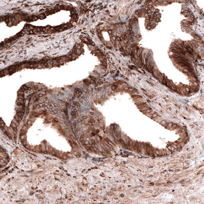Cyclophilin B Antibody (CL3901) - Azide and BSA Free Immunohistochemistry-Paraffin: Cyclophilin B Antibody [NBP3-44066]