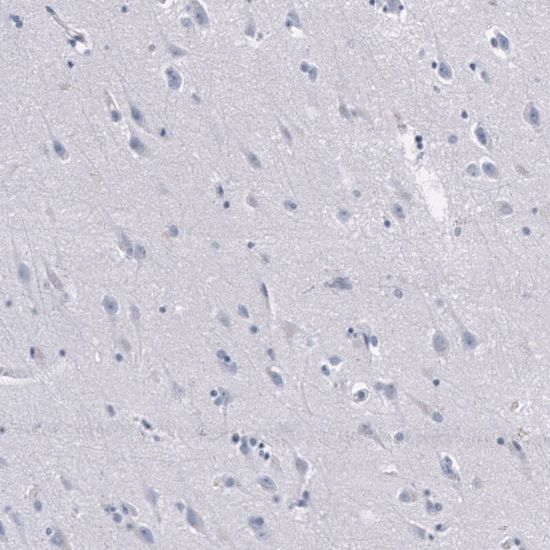 Granzyme B Antibody (CL10662) - Azide and BSA Free Immunohistochemistry-Paraffin: Granzyme B Antibody [NBP3-44068]