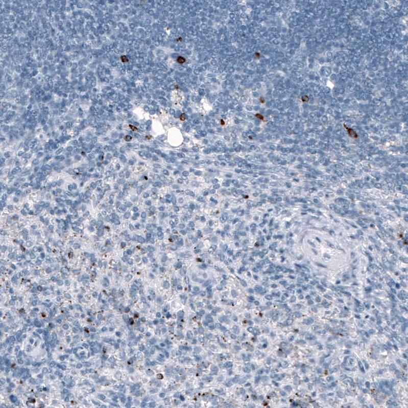 Granzyme B Antibody (CL10662) - Azide and BSA Free Immunohistochemistry-Paraffin: Granzyme B Antibody [NBP3-44068]