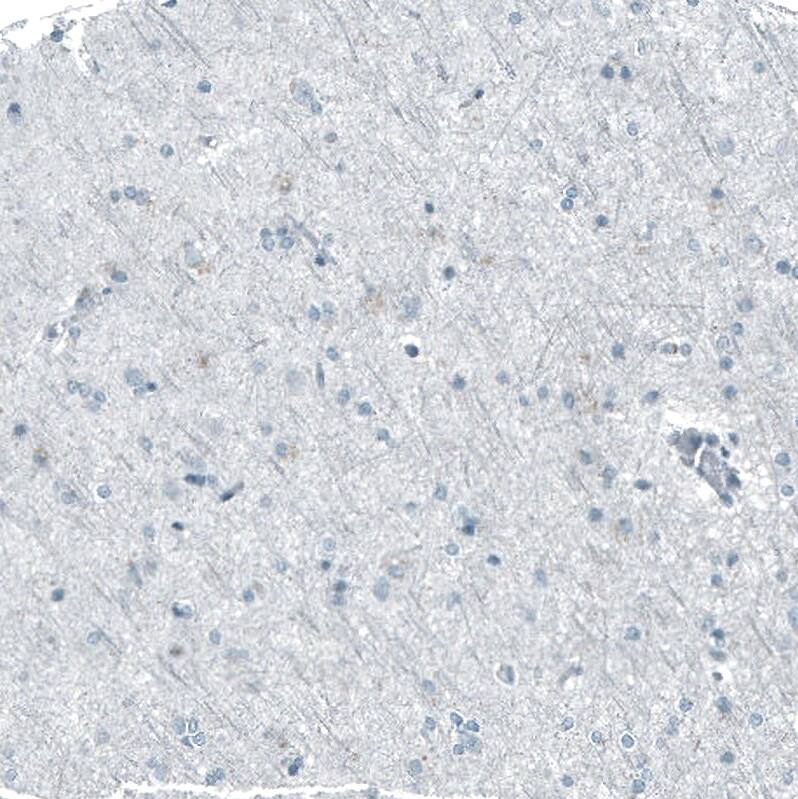 Chk2 Antibody (CL9440) - Azide and BSA Free Immunohistochemistry-Paraffin: Chk2 Antibody [NBP3-44069]