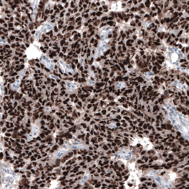 Chk2 Antibody (CL9440) - Azide and BSA Free Immunohistochemistry-Paraffin: Chk2 Antibody [NBP3-44069]