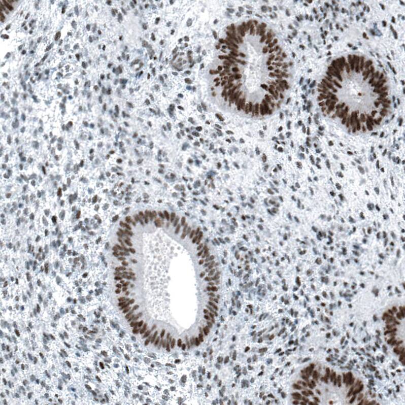 Chk2 Antibody (CL9440) - Azide and BSA Free Immunohistochemistry-Paraffin: Chk2 Antibody [NBP3-44069]