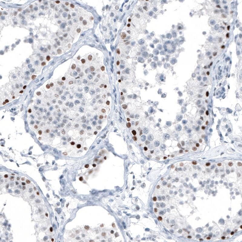 Chk2 Antibody (CL9440) - Azide and BSA Free Immunohistochemistry-Paraffin: Chk2 Antibody [NBP3-44069]