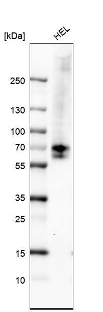 Chk2 Antibody (CL9440) - Azide and BSA Free Western Blot: Chk2 Antibody [NBP3-44069]