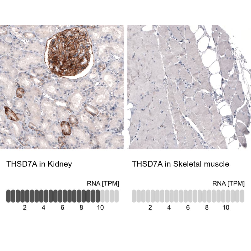 THSD7A Antibody (CL3778) - Azide and BSA Free Immunohistochemistry-Paraffin: THSD7A Antibody [NBP3-44071]