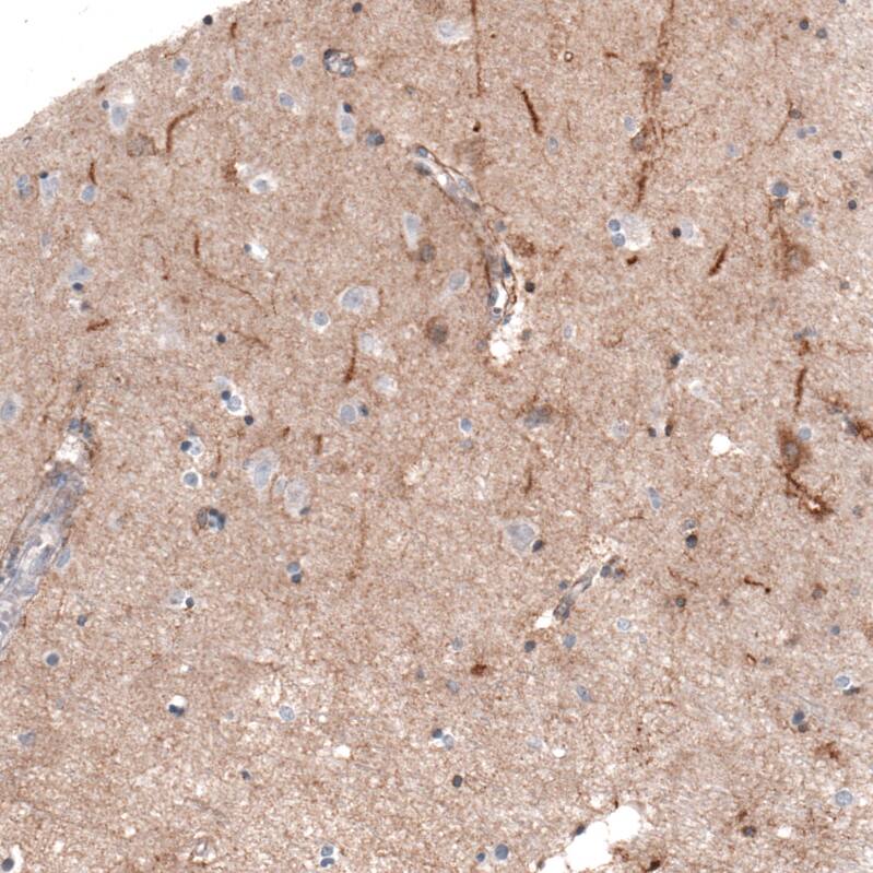 THSD7A Antibody (CL3778) - Azide and BSA Free Immunohistochemistry-Paraffin: THSD7A Antibody [NBP3-44071]