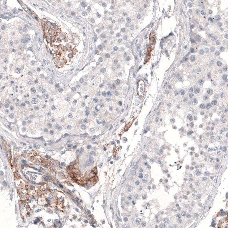 THSD7A Antibody (CL3778) - Azide and BSA Free Immunohistochemistry-Paraffin: THSD7A Antibody [NBP3-44071]