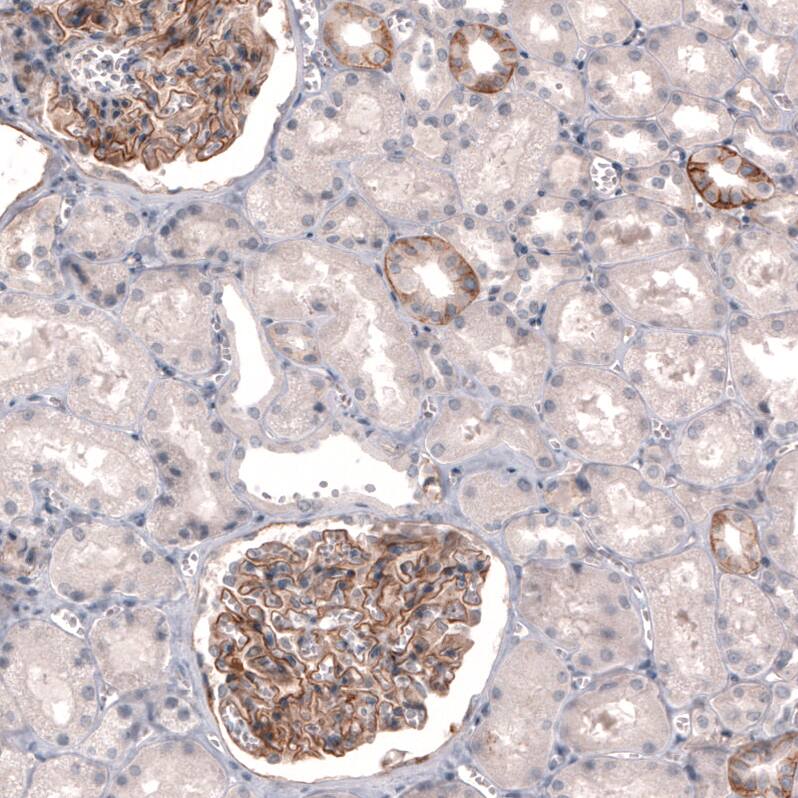 THSD7A Antibody (CL3779) - Azide and BSA Free Immunohistochemistry-Paraffin: THSD7A Antibody [NBP3-44072]