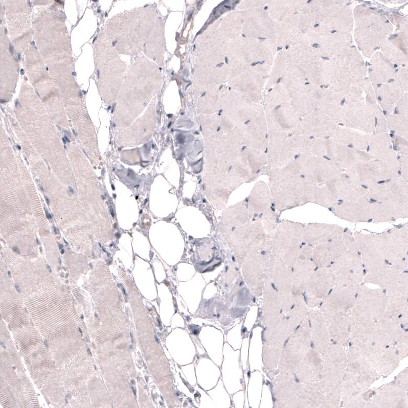THSD7A Antibody (CL3779) - Azide and BSA Free Immunohistochemistry-Paraffin: THSD7A Antibody [NBP3-44072]