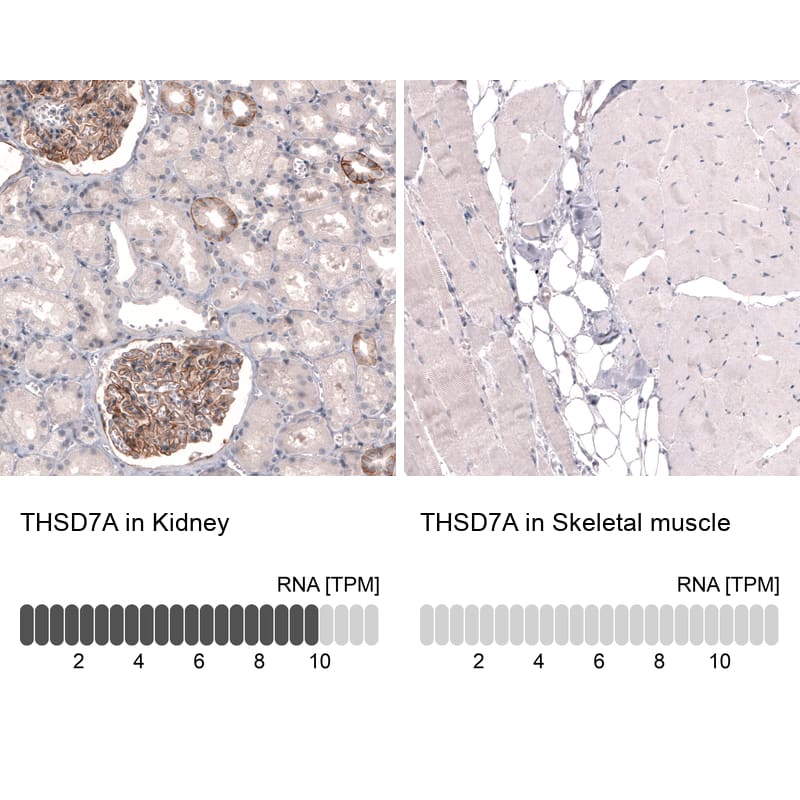 THSD7A Antibody (CL3779) - Azide and BSA Free Immunohistochemistry-Paraffin: THSD7A Antibody [NBP3-44072]