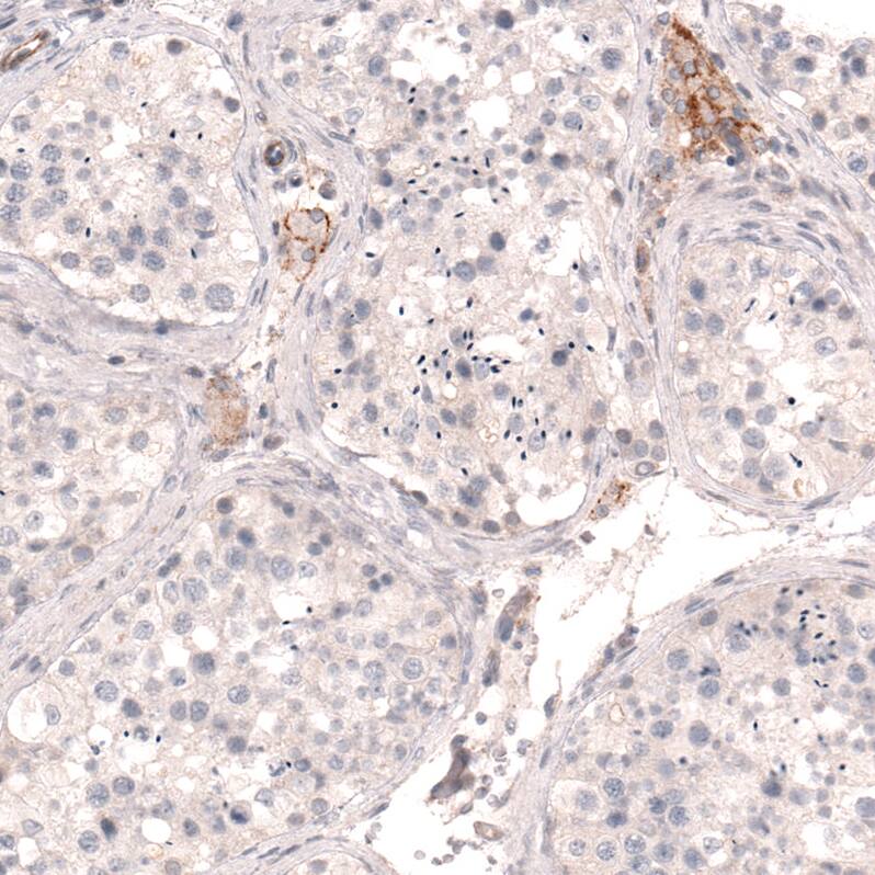 THSD7A Antibody (CL3779) - Azide and BSA Free Immunohistochemistry-Paraffin: THSD7A Antibody [NBP3-44072]