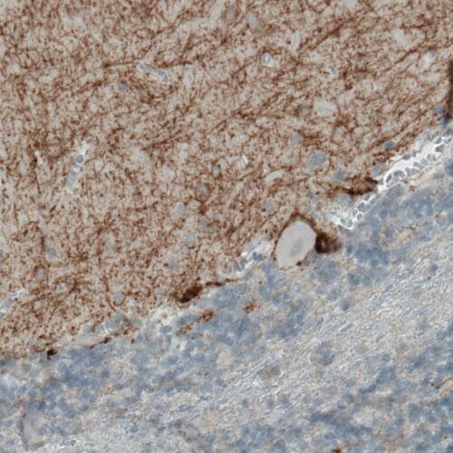 CD117/c-kit Antibody (CL1667) - Azide and BSA Free Immunohistochemistry-Paraffin: CD117/c-kit Antibody [NBP3-44073]