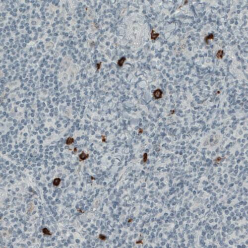 CD117/c-kit Antibody (CL1667) - Azide and BSA Free Immunohistochemistry-Paraffin: CD117/c-kit Antibody [NBP3-44073]