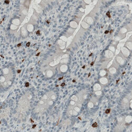 CD117/c-kit Antibody (CL1667) - Azide and BSA Free Immunohistochemistry-Paraffin: CD117/c-kit Antibody [NBP3-44073]