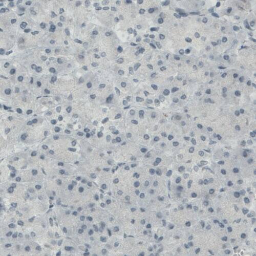 CD117/c-kit Antibody (CL1667) - Azide and BSA Free Immunohistochemistry-Paraffin: CD117/c-kit Antibody [NBP3-44073]
