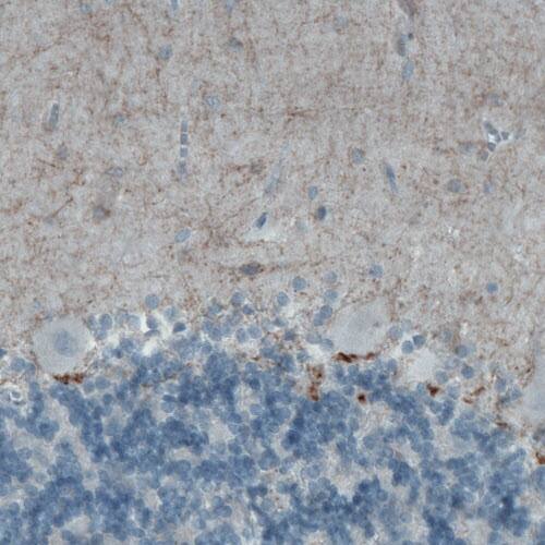 CD117/c-kit Antibody (CL1657) - Azide and BSA Free Immunohistochemistry-Paraffin: CD117/c-kit Antibody [NBP3-44075]