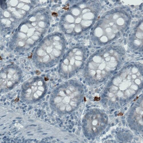 CD117/c-kit Antibody (CL1657) - Azide and BSA Free Immunohistochemistry-Paraffin: CD117/c-kit Antibody [NBP3-44075]