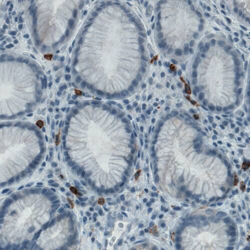 CD117/c-kit Antibody (CL1657) - Azide and BSA Free Immunohistochemistry-Paraffin: CD117/c-kit Antibody [NBP3-44075]