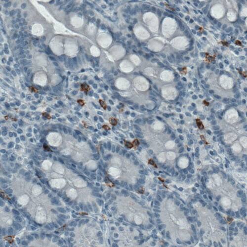 CD117/c-kit Antibody (CL1657) - Azide and BSA Free Immunohistochemistry-Paraffin: CD117/c-kit Antibody [NBP3-44075]
