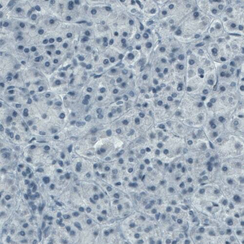 CD117/c-kit Antibody (CL1657) - Azide and BSA Free Immunohistochemistry-Paraffin: CD117/c-kit Antibody [NBP3-44075]