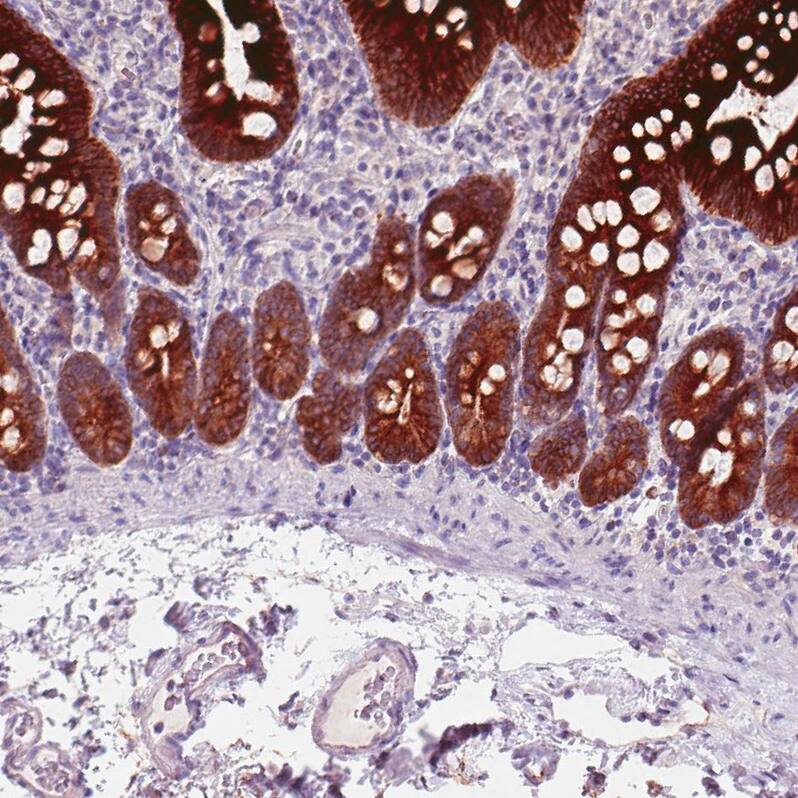 ACSL5 Antibody (CL0275) - Azide and BSA Free Immunohistochemistry-Paraffin: ACSL5 Antibody [NBP3-44076]