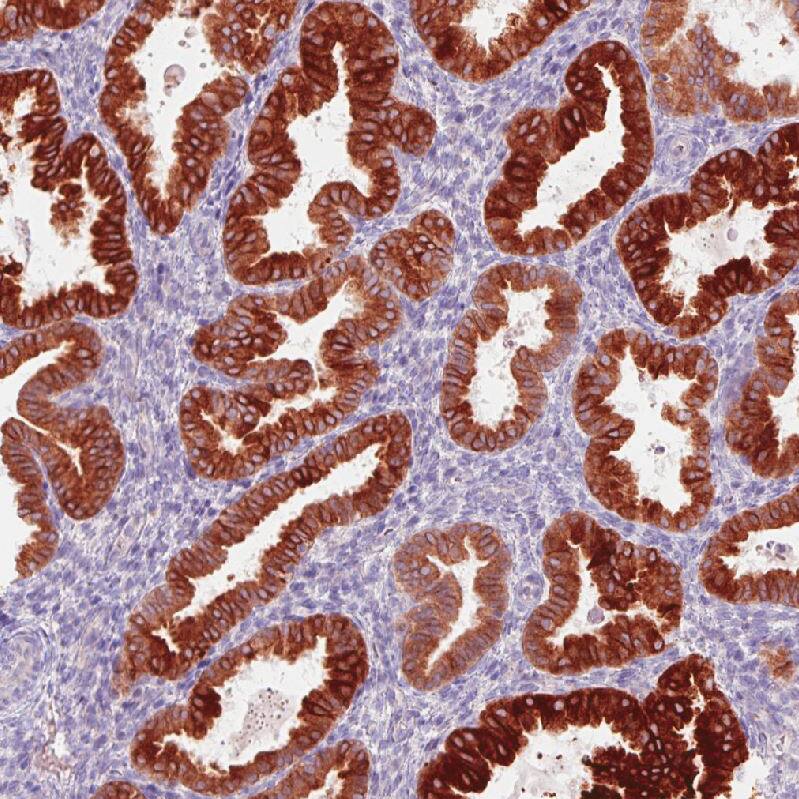 ACSL5 Antibody (CL0275) - Azide and BSA Free Immunohistochemistry-Paraffin: ACSL5 Antibody [NBP3-44076]