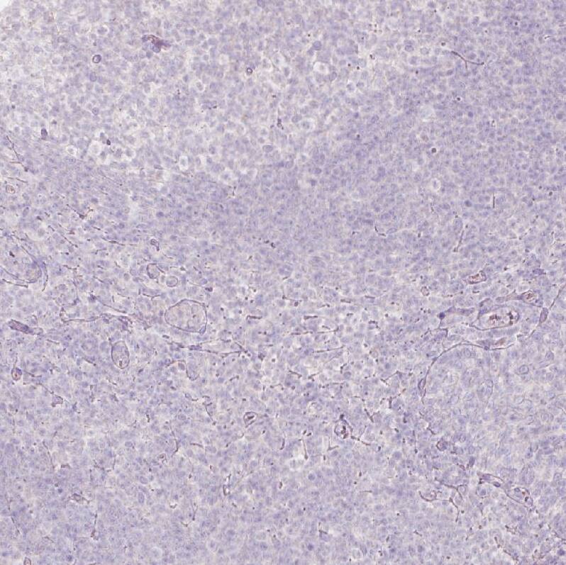 ACSL5 Antibody (CL0275) - Azide and BSA Free Immunohistochemistry-Paraffin: ACSL5 Antibody [NBP3-44076]
