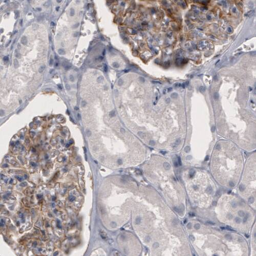 Coagulation Factor III/Tissue Factor Antibody (CL3805) - Azide and BSA Free Immunohistochemistry-Paraffin: Coagulation Factor III/Tissue Factor Antibody [NBP3-44077]