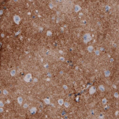 Coagulation Factor III/Tissue Factor Antibody (CL3805) - Azide and BSA Free Immunohistochemistry-Paraffin: Coagulation Factor III/Tissue Factor Antibody [NBP3-44077]