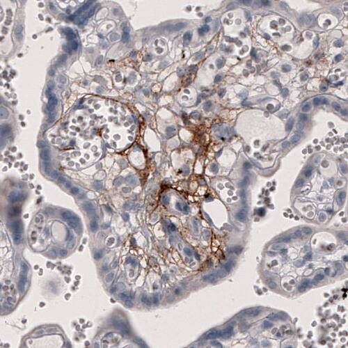 Coagulation Factor III/Tissue Factor Antibody (CL3805) - Azide and BSA Free Immunohistochemistry-Paraffin: Coagulation Factor III/Tissue Factor Antibody [NBP3-44077]