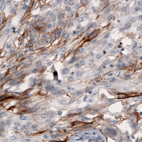 Coagulation Factor III/Tissue Factor Antibody (CL3805) - Azide and BSA Free Immunohistochemistry-Paraffin: Coagulation Factor III/Tissue Factor Antibody [NBP3-44077]