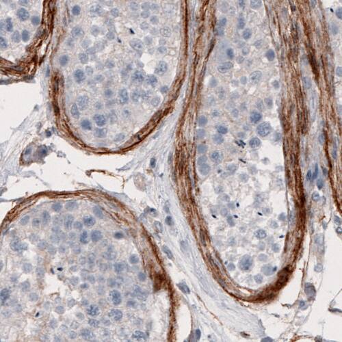 Coagulation Factor III/Tissue Factor Antibody (CL3805) - Azide and BSA Free Immunohistochemistry-Paraffin: Coagulation Factor III/Tissue Factor Antibody [NBP3-44077]