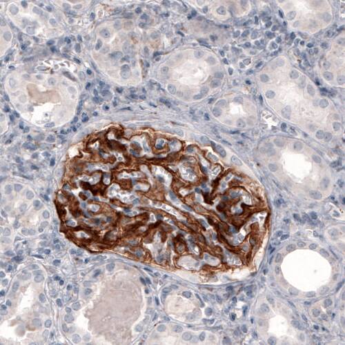 Coagulation Factor III/Tissue Factor Antibody (CL3807) - Azide and BSA Free Immunohistochemistry-Paraffin: Coagulation Factor III/Tissue Factor Antibody [NBP3-44078]